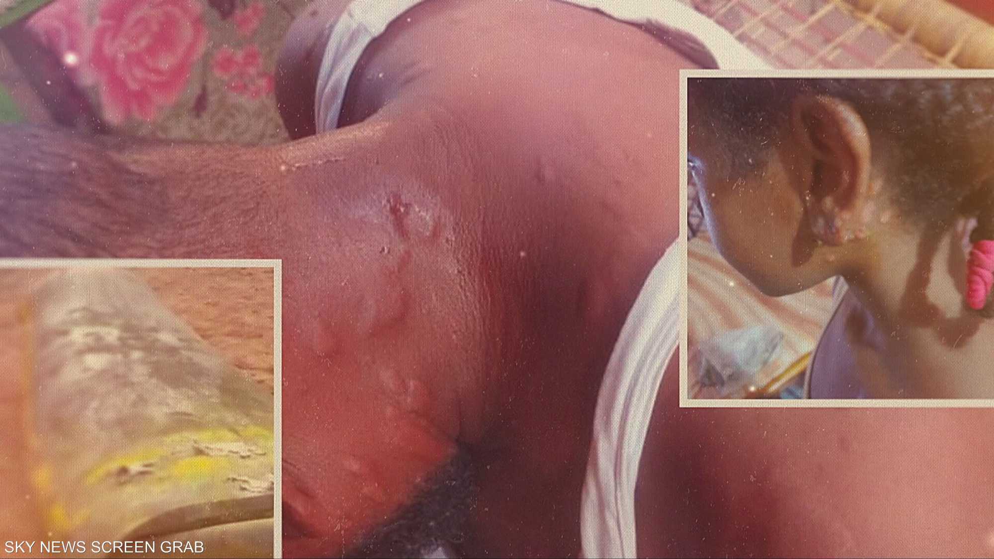 السودان.. خفايا استخدام الكيماوي في الحرب