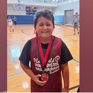 أصيب الطفل بحروق من الدرجة الثانية