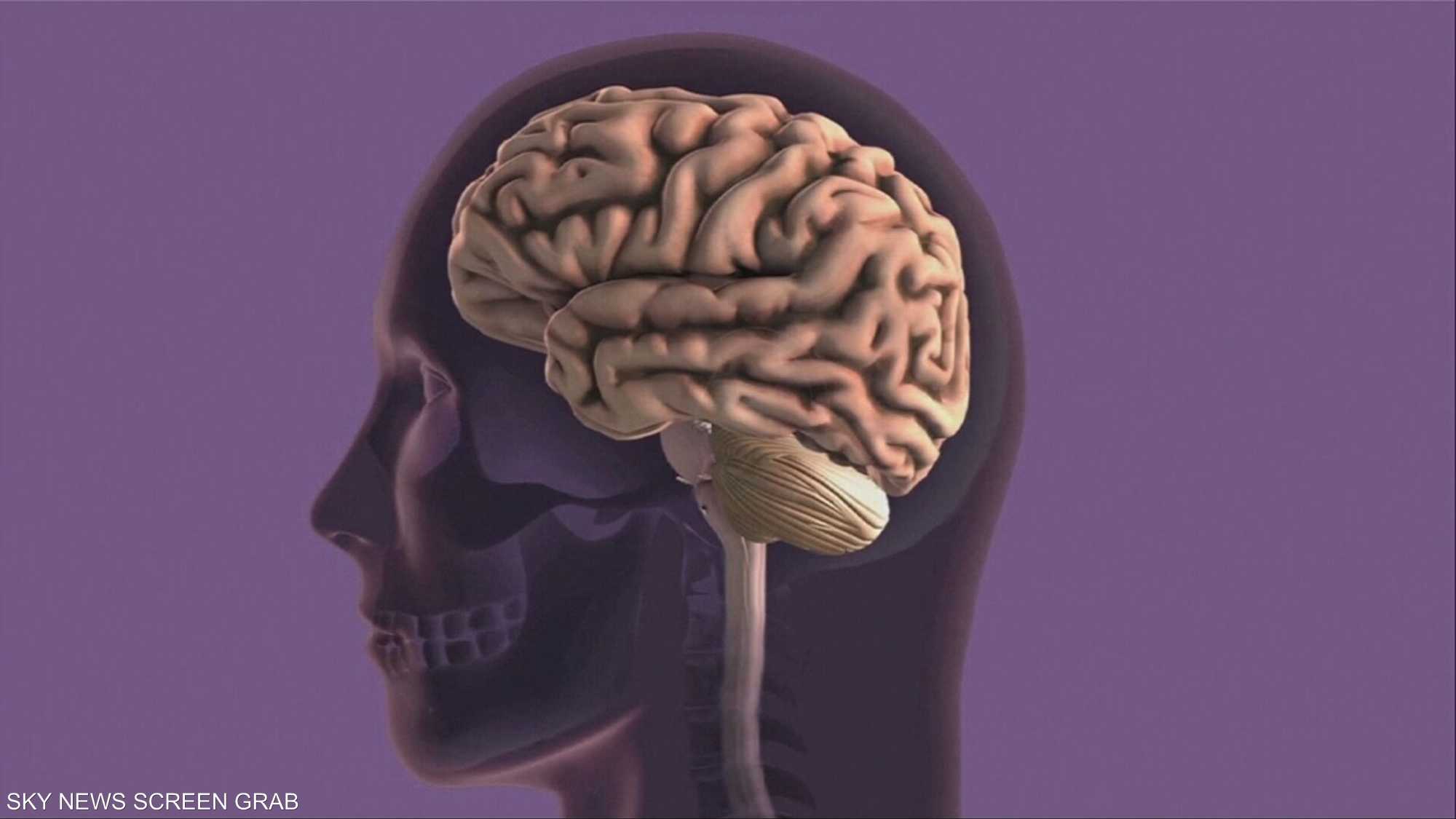 دواء للزهايمر يحقق نتائج واعدة في تأخير المرض 8 سنوات