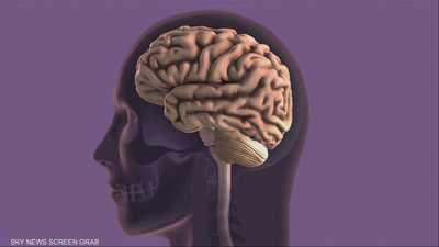 دواء للزهايمر يحقق نتائج واعدة في تأخير المرض 8 سنوات