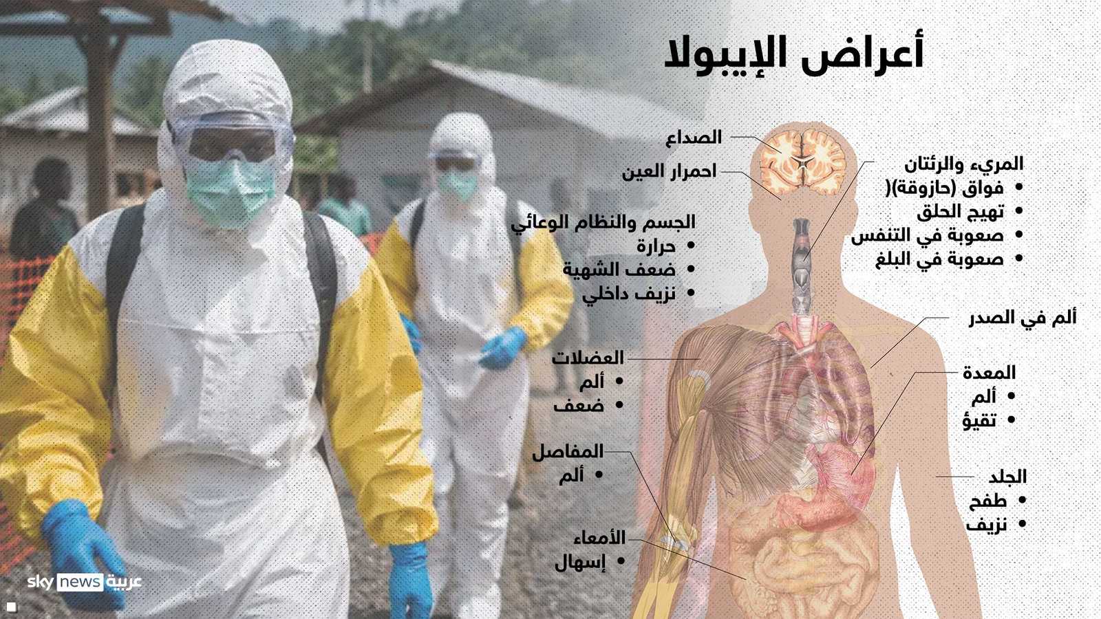 أعراض المرض