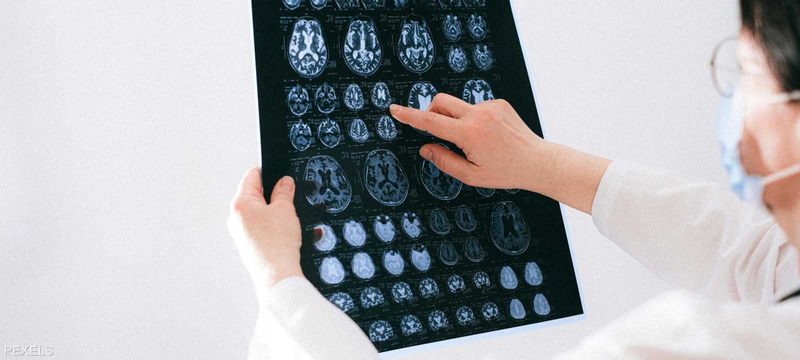 طرق لإبطاء شيخوخة الدماغ