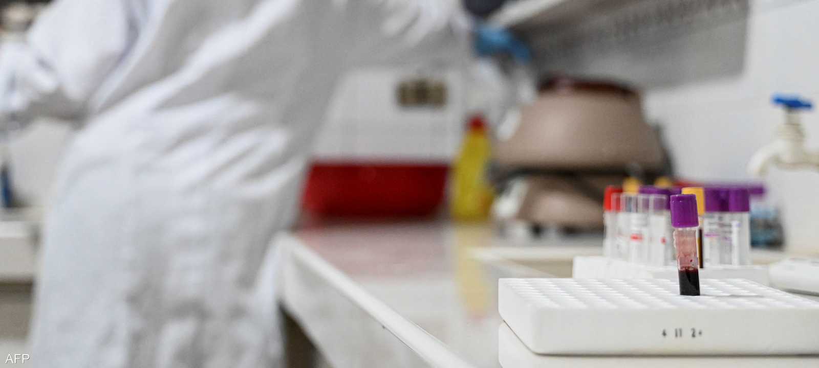 أزمة تمويل تهدد القضاء على الإيدز