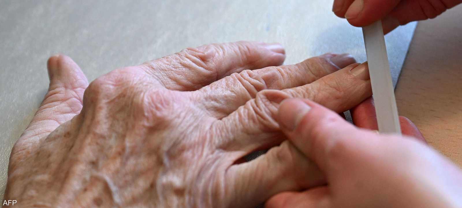 الأظافر مؤشر مهم بالنسبة للحال الصحية