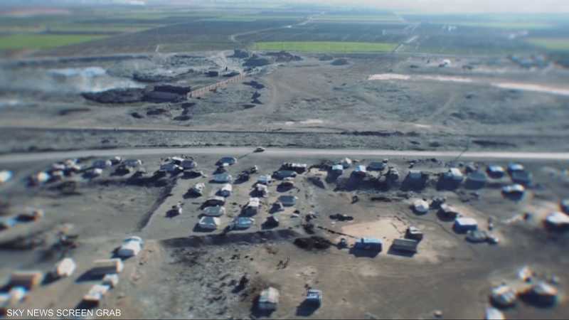 اللشمانيا يعود إلى الواجهة من جديد وتسجيل آلاف الإصابات