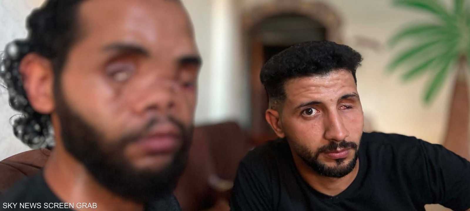 جراح الحرب تحاصر عائلة دبور في مخيم الشاطئ