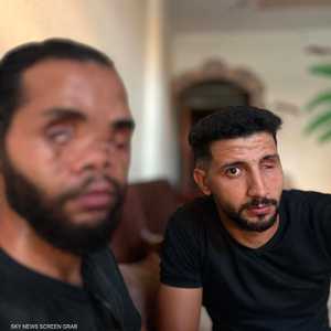 جراح الحرب تحاصر عائلة دبور في مخيم الشاطئ