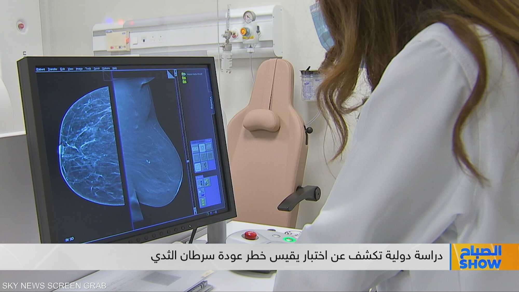 البصمة الجينية تحسم مصير العلاج الكيماوي