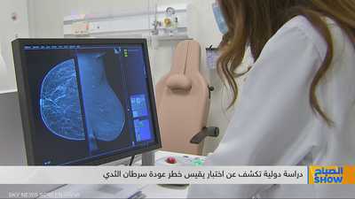 البصمة الجينية تحسم مصير العلاج الكيماوي