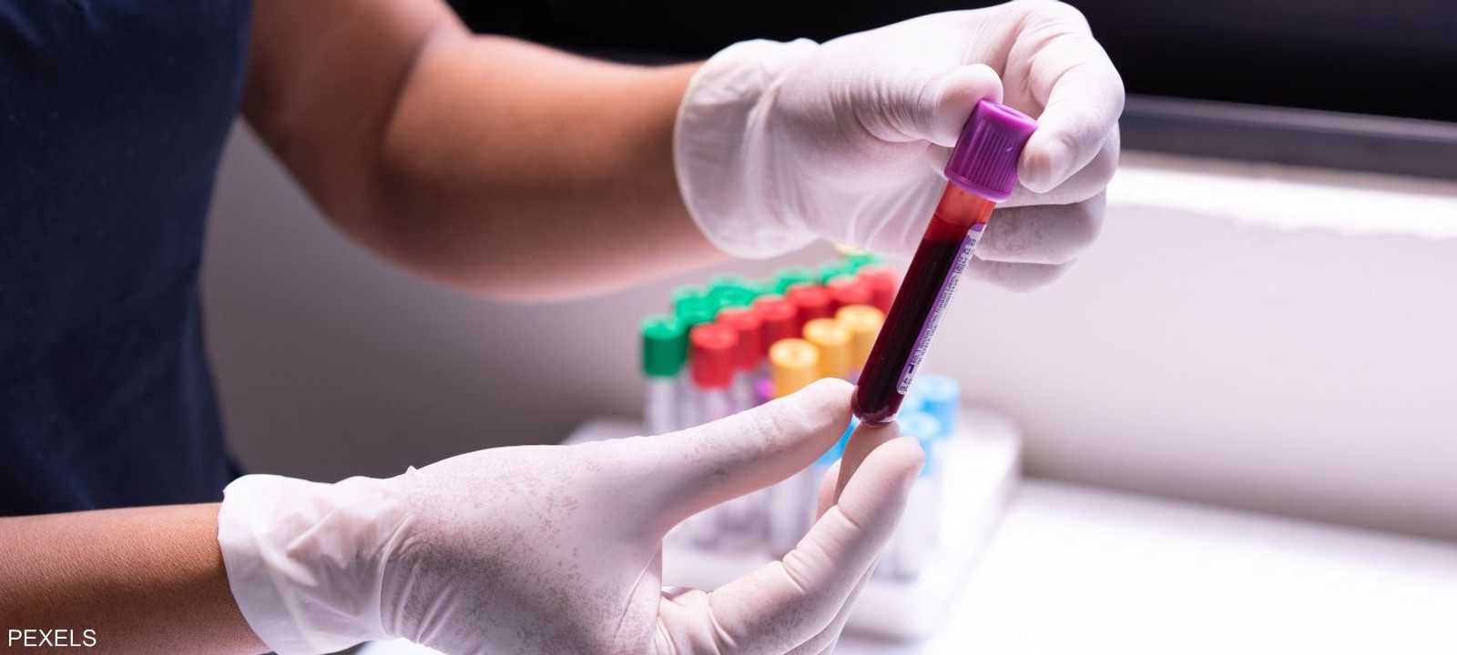 اقتربت فكرة إنتاج لقاح خاص بكل مريض سرطان من التحقق