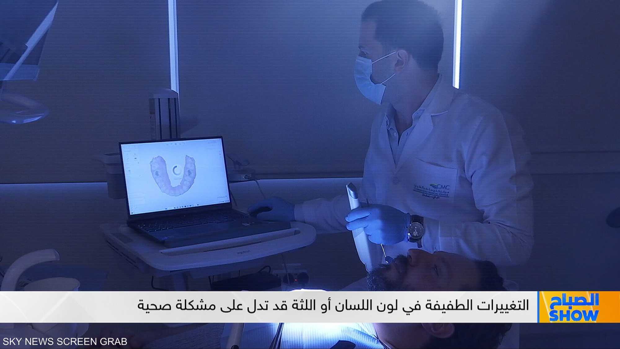 أمراض مزمنة يكشفها الفم قبل الجسم.. ما هي؟