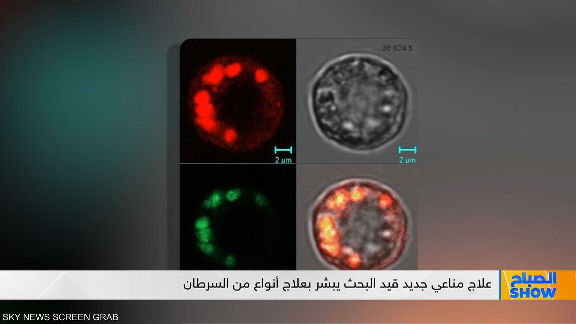 خلايا مناعية ضد الأورام الصلبة .. أمل واعد لعلاج السرطان