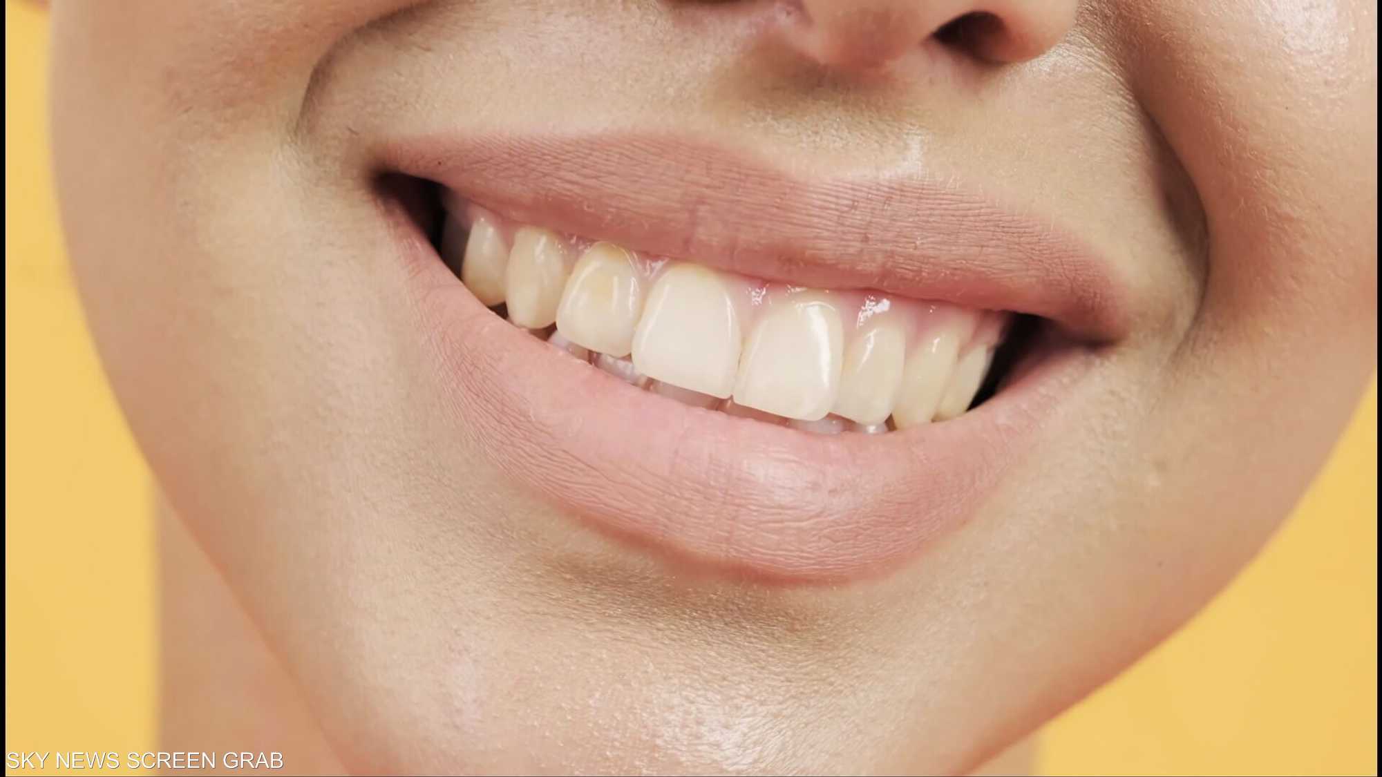 أخطاء في الفينير ممكن أن تدمر أسنانك