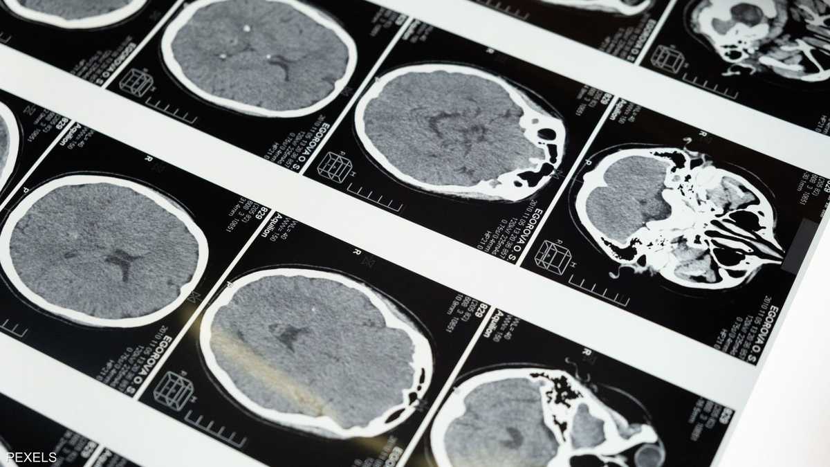 دراسة علمية: الدماغ ليس عضوا واحدا بل ينشأ من مجموعتين مختلفتين من الخلايا