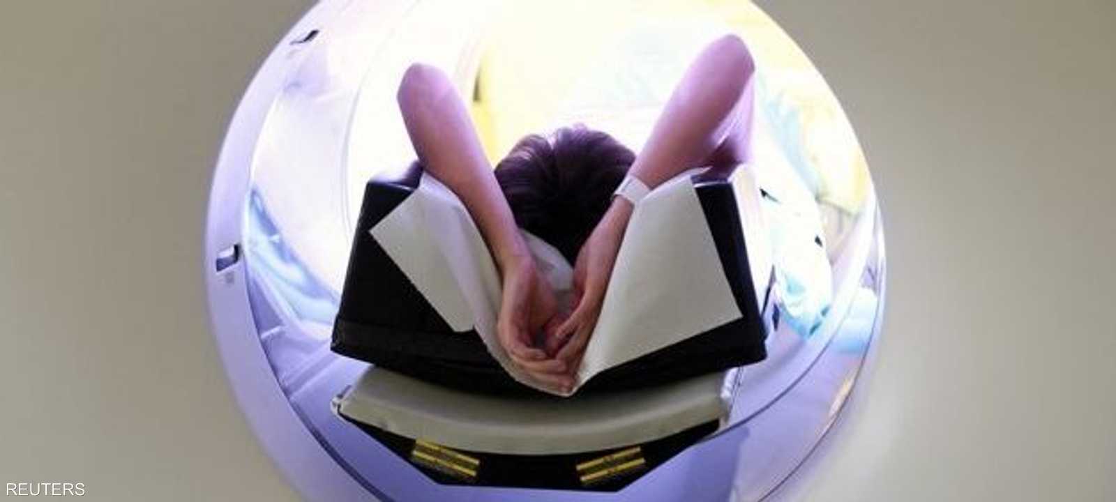 أرقام جديدة تكشف تسارع السرطان بين الأجيال الأصغر