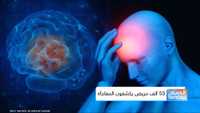 %91.. توقع الصداع قبل حدوثه؟