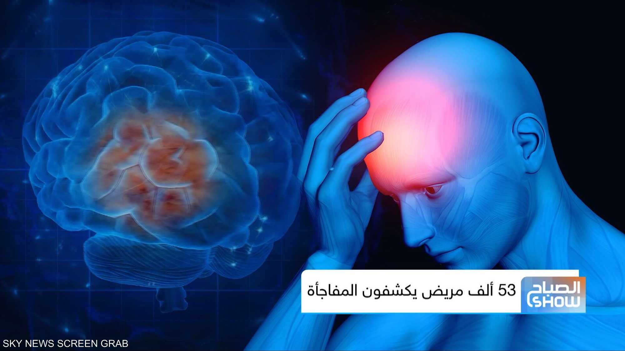 %91.. توقع الصداع قبل حدوثه؟