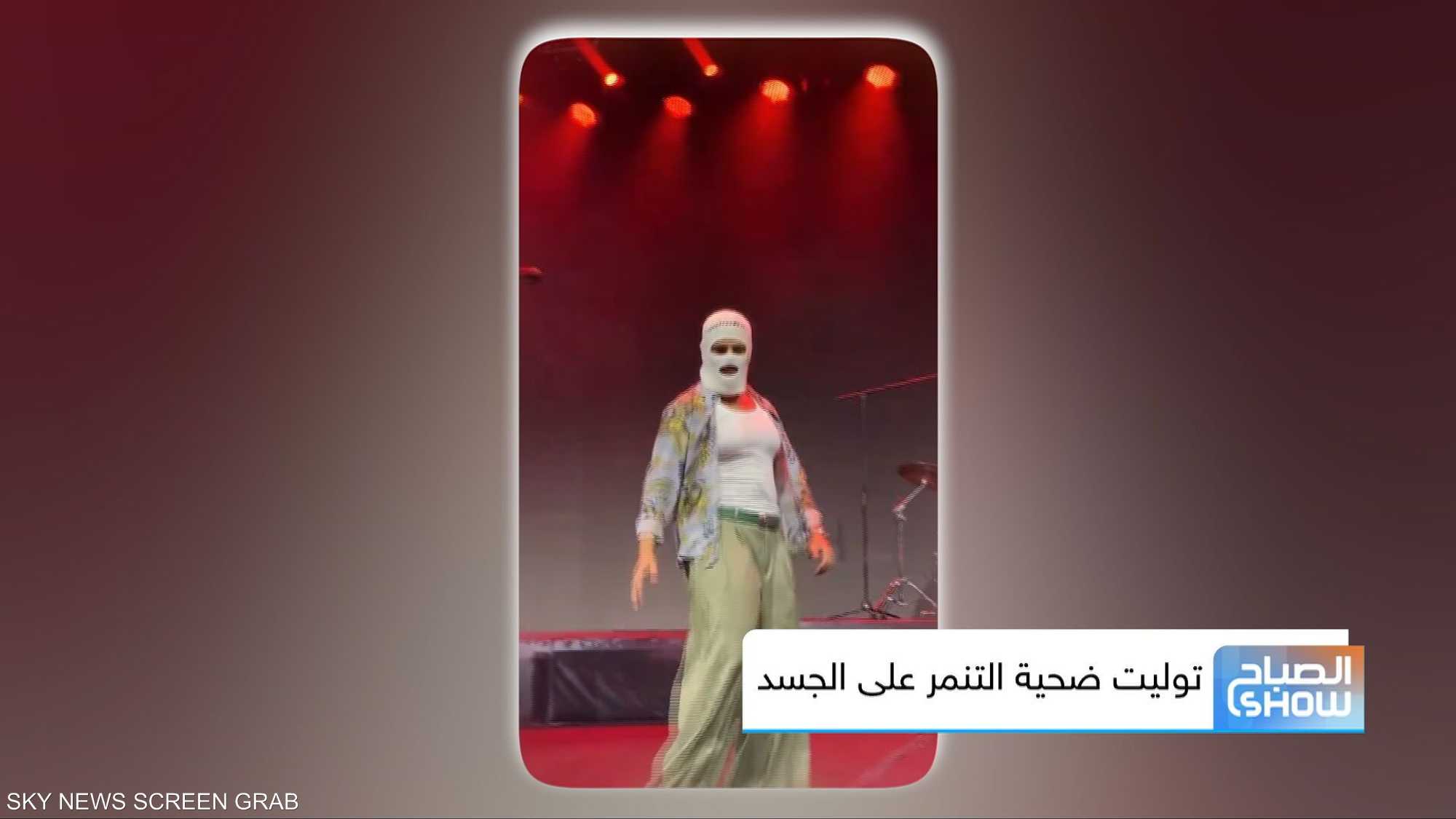 توليت ضحية التنمر على الجسد