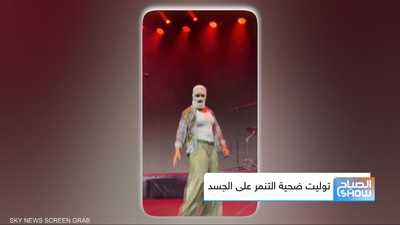 توليت ضحية التنمر على الجسد