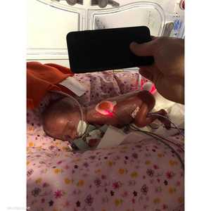 الرضيعة ولدت بحجم لا يصدق