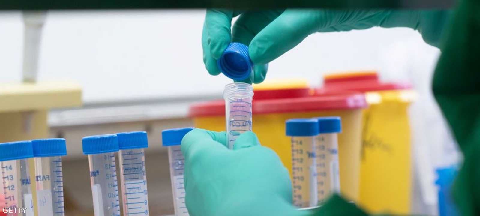 اللقاح قد يكون أن سيناريوهات نهاية كورونا