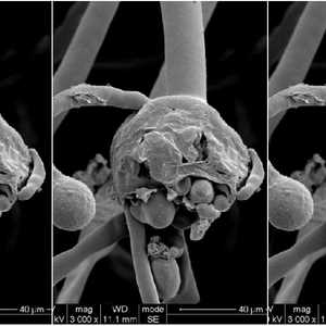 تصوير بالأشعة يظهر عقد الفطر الأسود لدى أحد المصابين