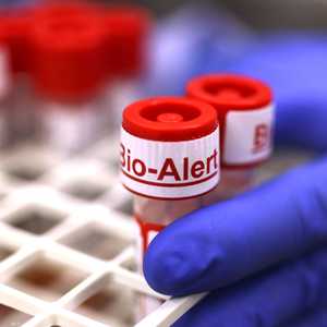 عينة من فيروس جدري القرود