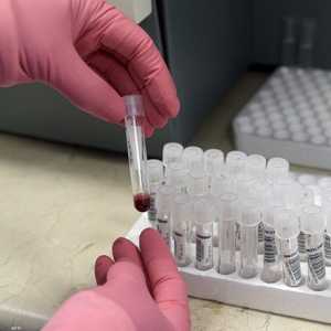 نوفمبر يشهد حملات مكثفة للتوعية عن سرطان البروستات