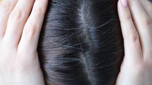 سبتمبر المقبل قد يسبب تزايدا في حالات "تساقط الشعر الموسمي"