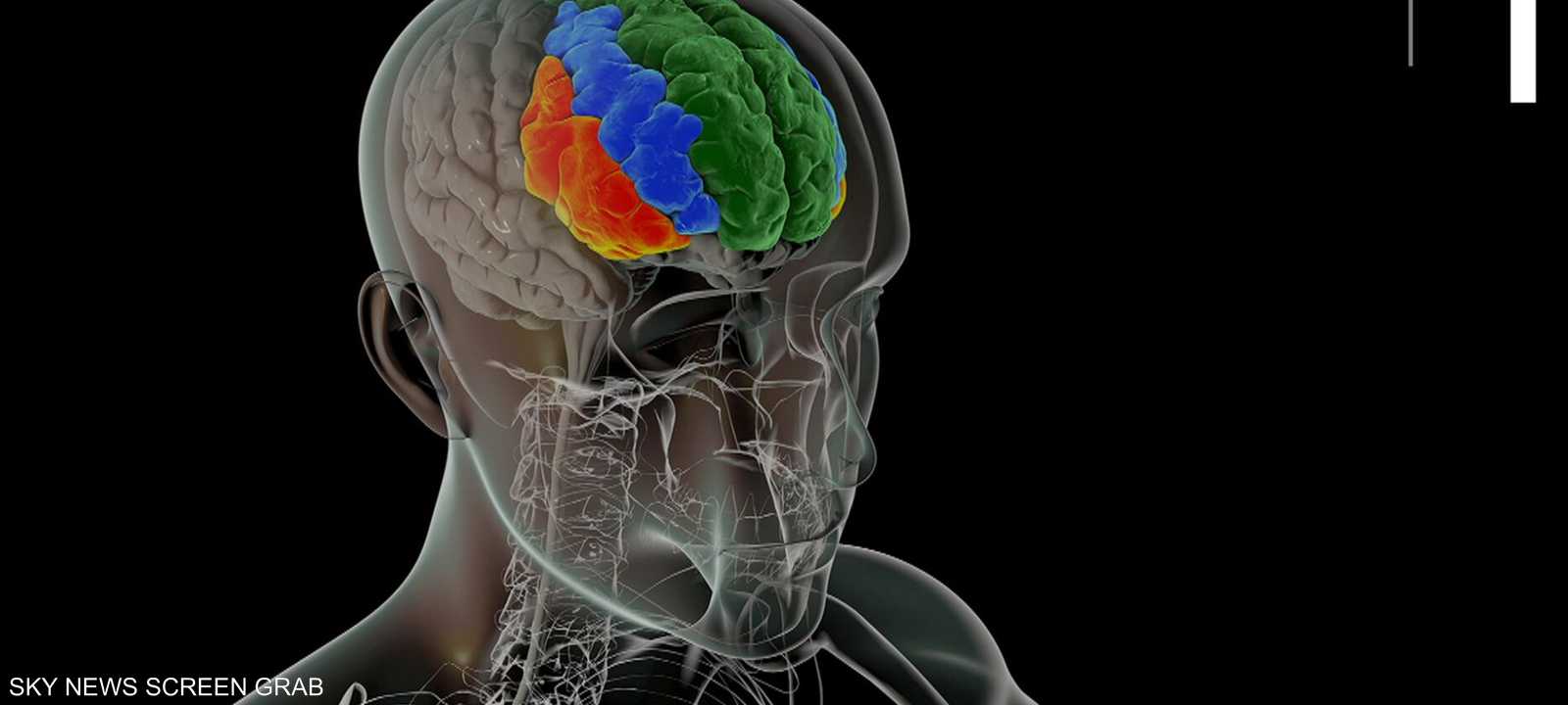 أدوية خفض الكوليسترول قد تقلل أيضا من خطر الإصابة بالخرف