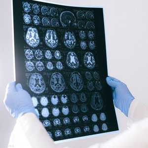 التكنولوجيا استطاعت "قراءة" الأفكار وترجمتها للغة