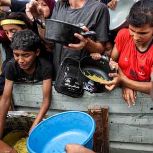 أطفال غزة يعانون من نقص حاد في الغذاء