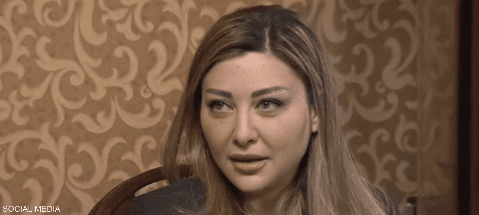 الشبل تعرضت لحادث سير مؤخرا