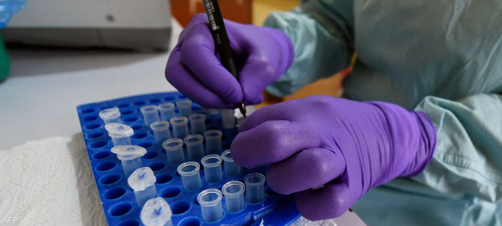 غيان-باريه حالة يهاجم فيه الجهاز المناعي للجسم الأعصاب