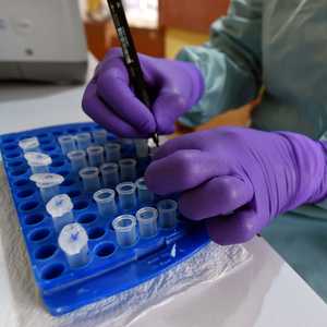 غيان-باريه حالة يهاجم فيه الجهاز المناعي للجسم الأعصاب