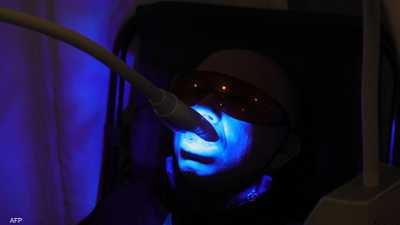 تبييض الأسنان.. تحذير من منتجات "خطيرة" تباع عبر الإنترنت