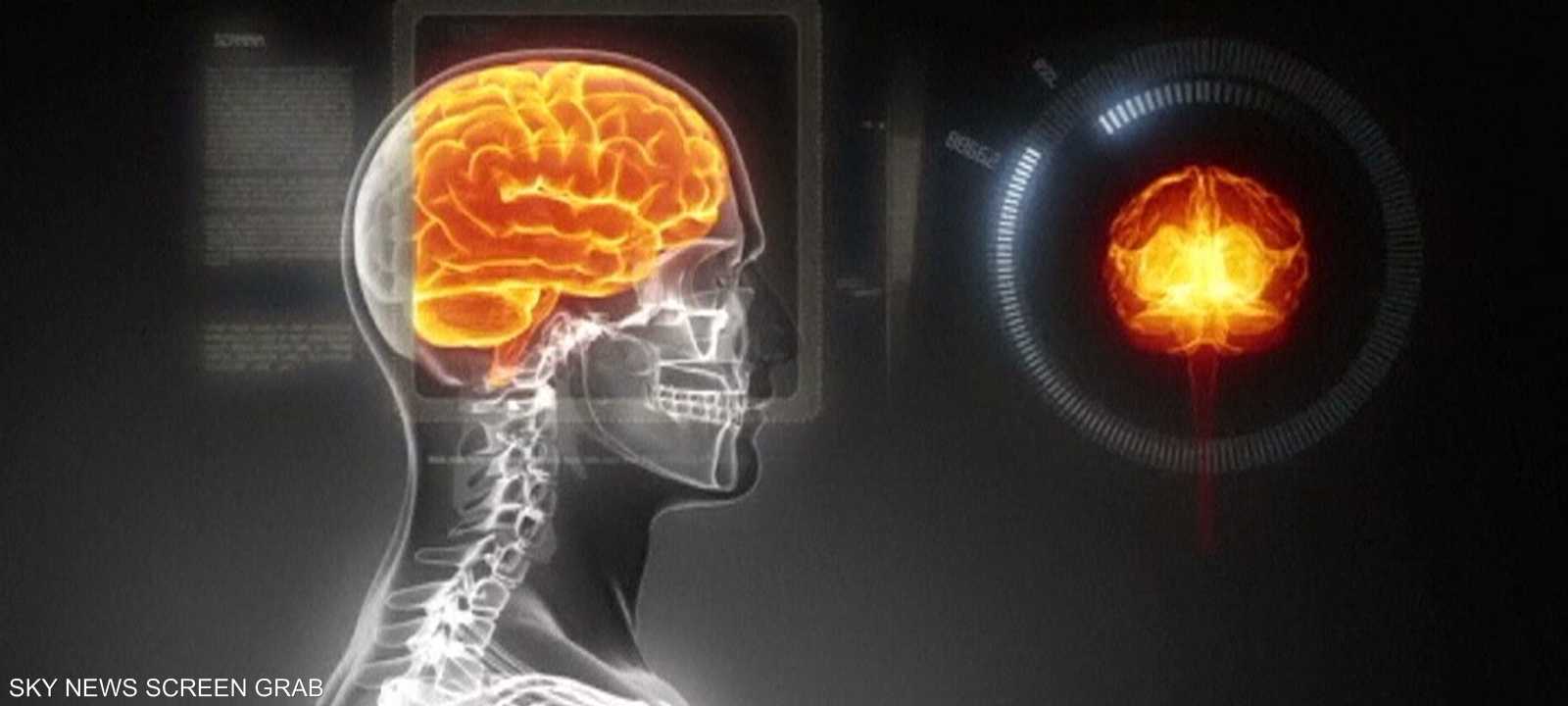 التوتر وراء الشيخوخة العصبية المبكرة