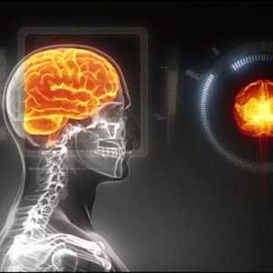 التوتر وراء الشيخوخة العصبية المبكرة